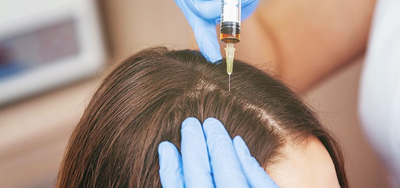 PRP Hair Treatment